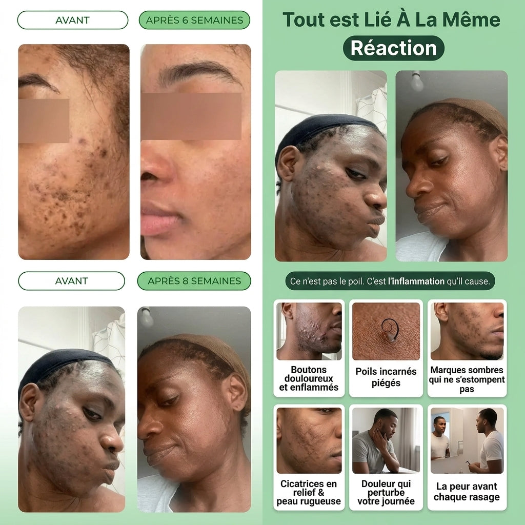 Le Savon au Curcuma pour une Peau Éclatante